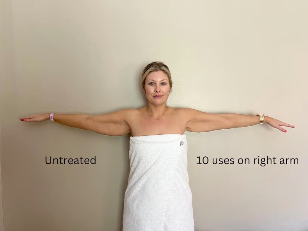 Nu Skin RenuSpa Results Before and After