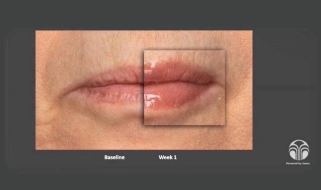 Nu Colour Peptide Pout results