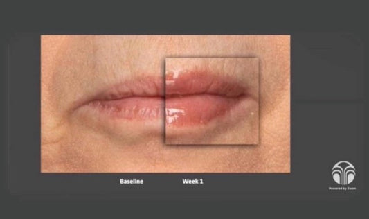 Nu Colour Peptide Pout results