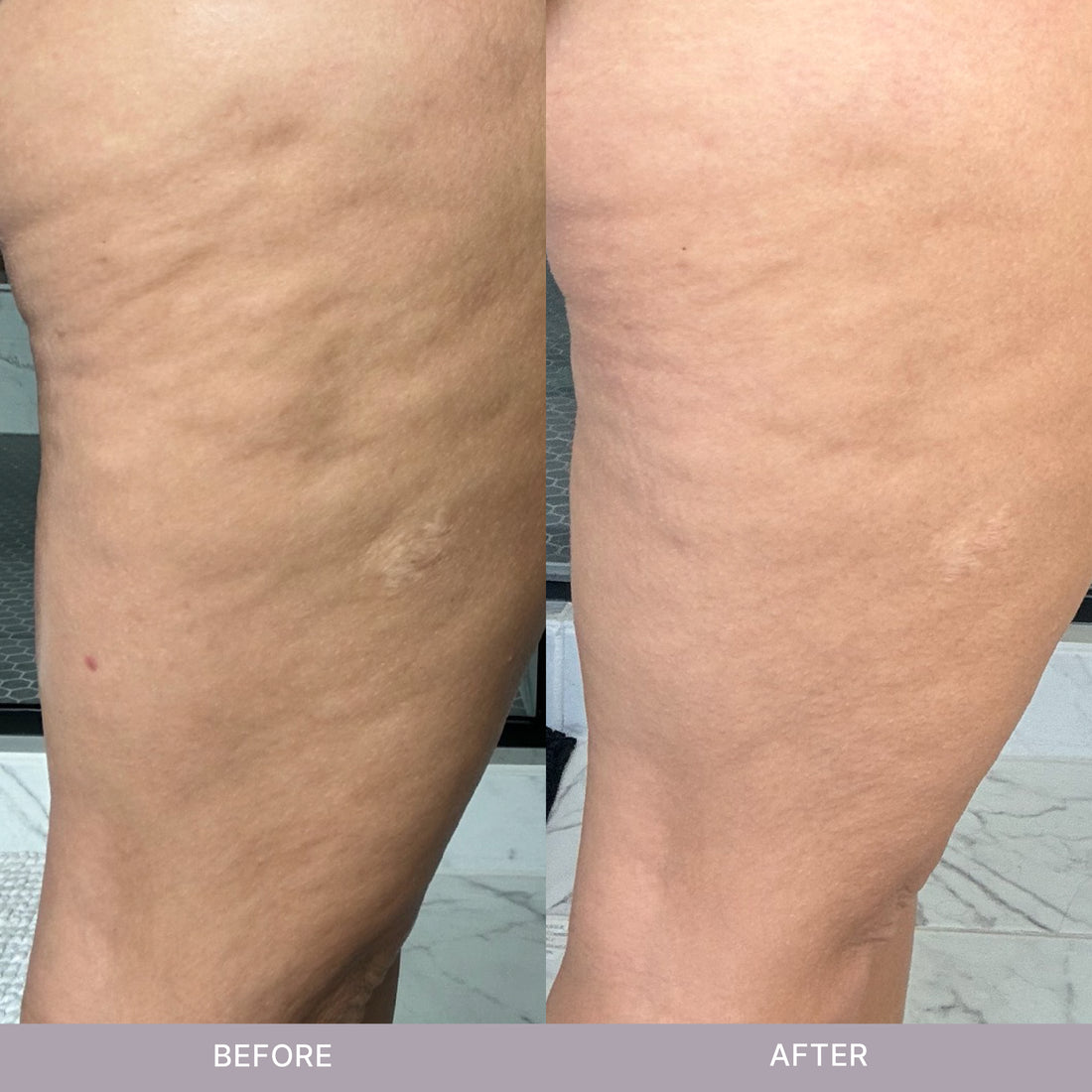 NuSkinRenuSpa iO Results side by side of female legs