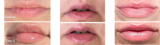 Peptide Pout Results
