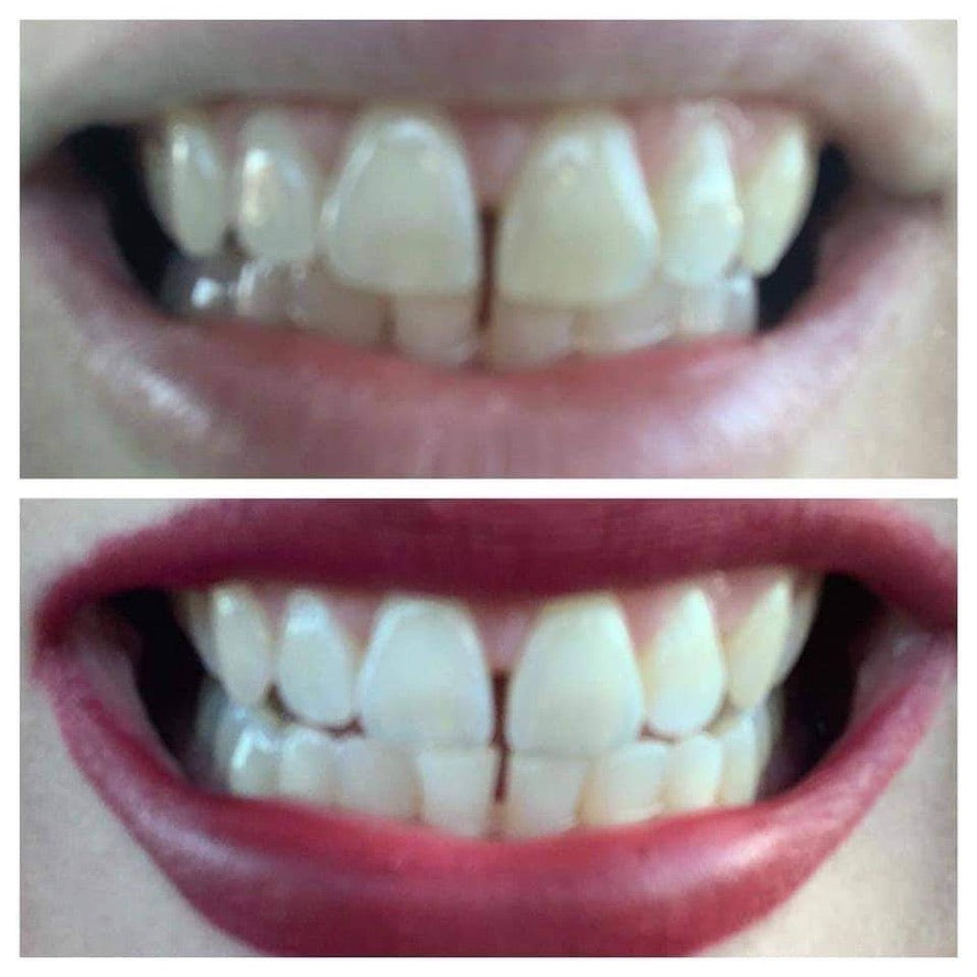 Whiten it Up! AP24 Toothpaste