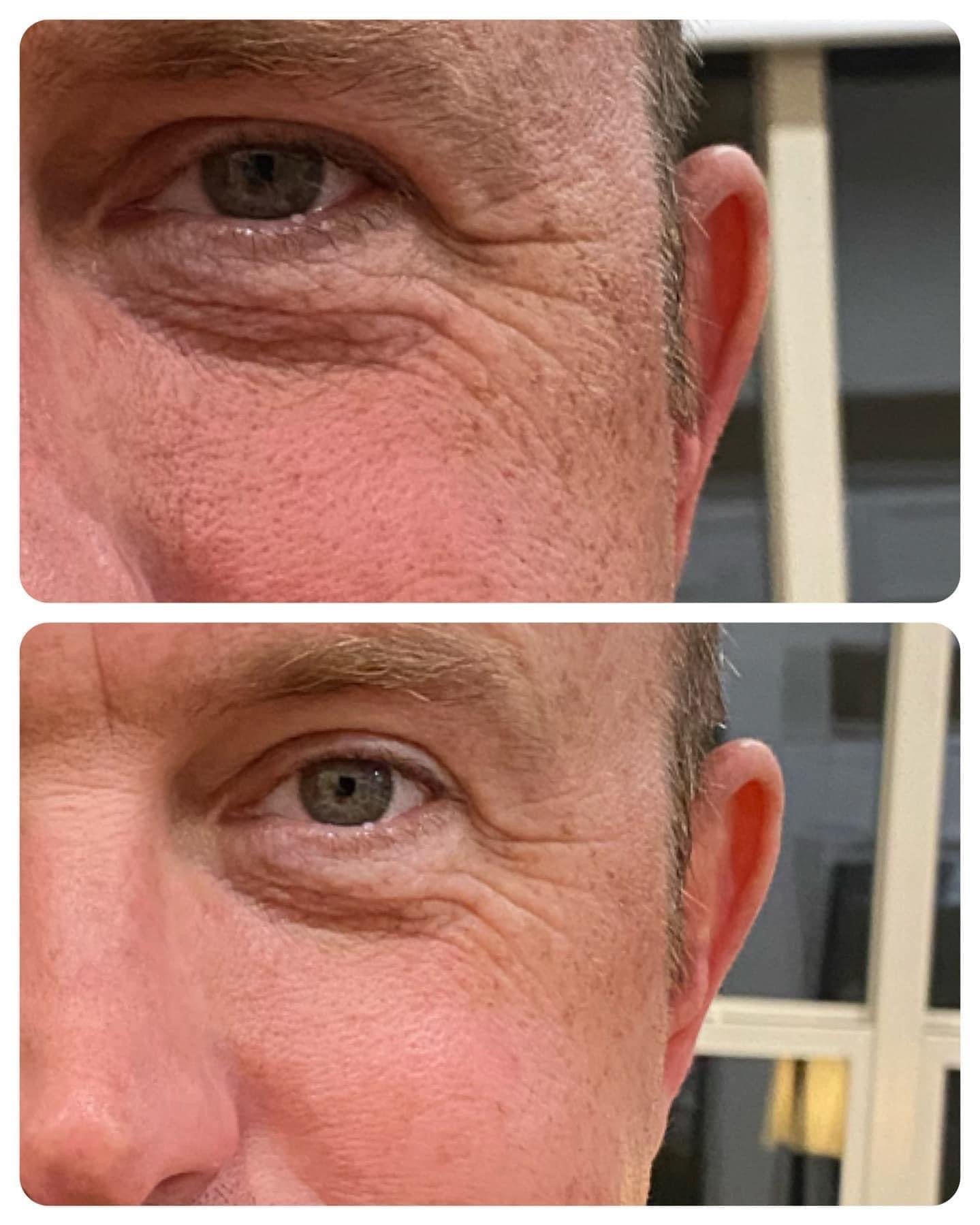 Boost Hydration Overnight - Pillow Glow