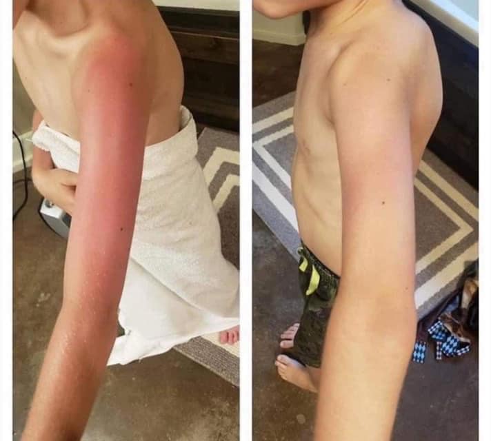 Sunburn Blaster - Epoch Body Butter!