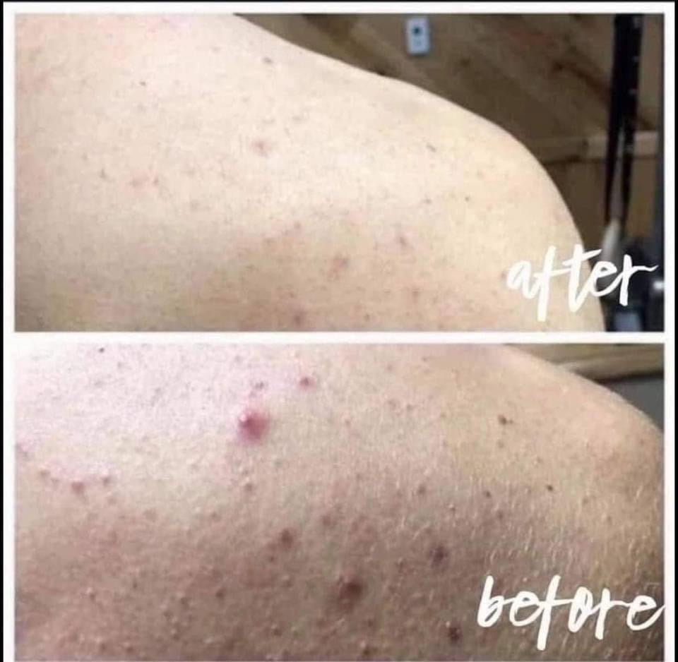 Gentle Exfoliation, KP relief - Epoch Polishing Bar
