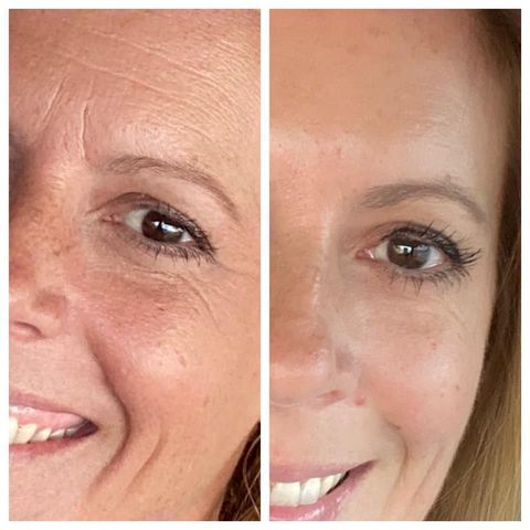 Tru Face Line Corrector