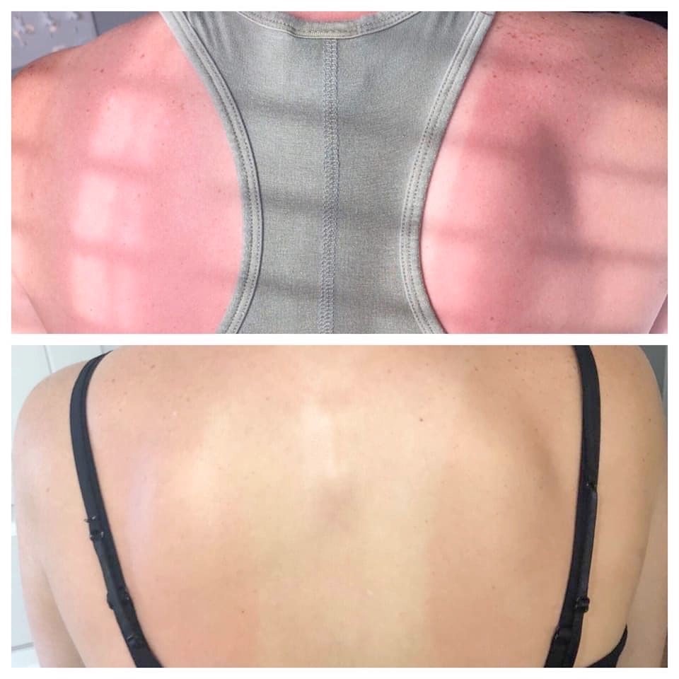 Sunburn Blaster - Epoch Body Butter!