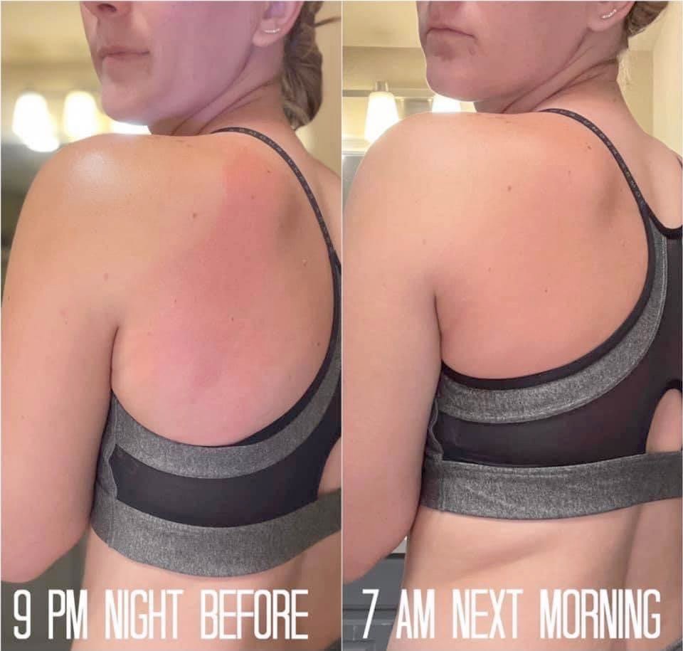 Sunburn Blaster - Epoch Body Butter!