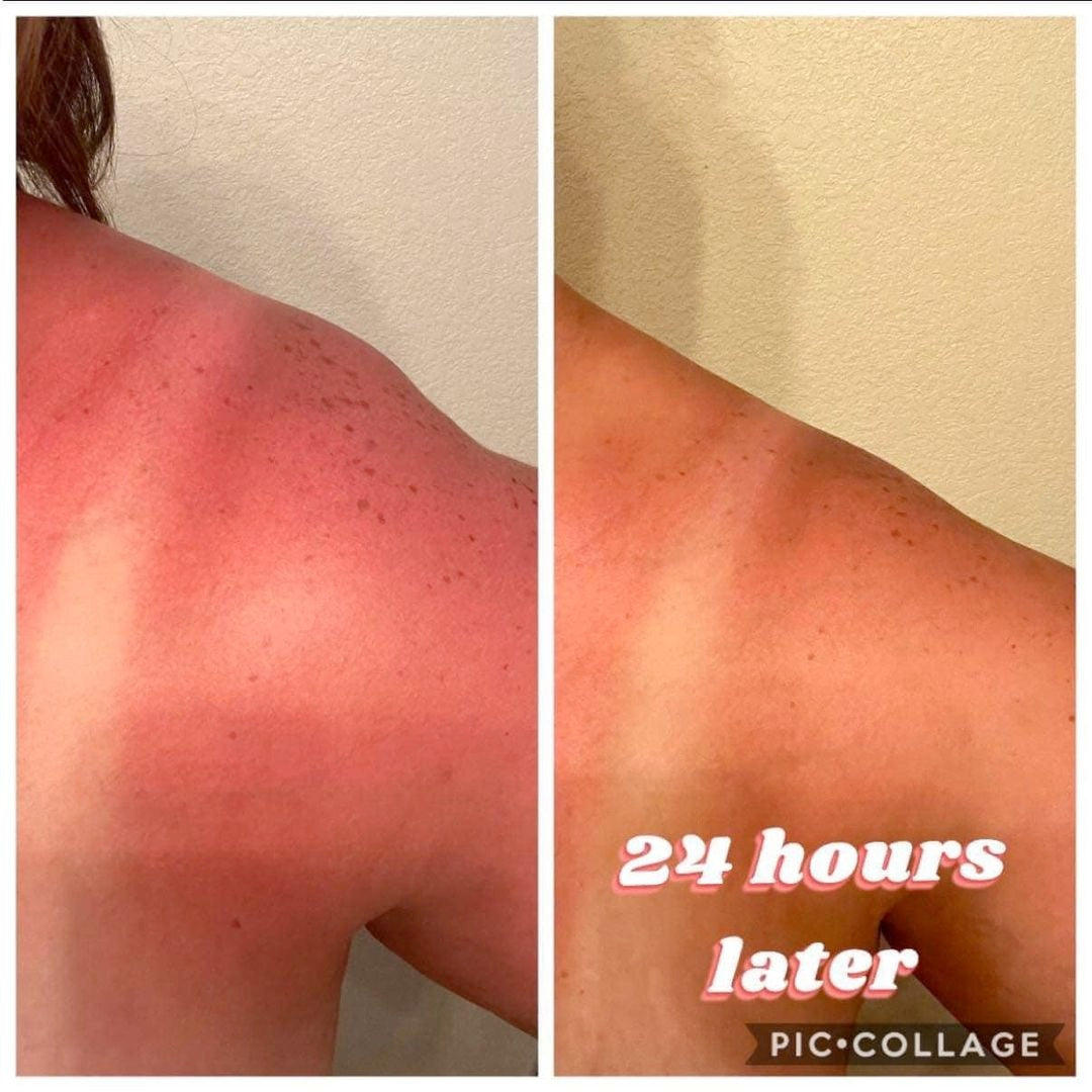 Sunburn Blaster - Epoch Body Butter!