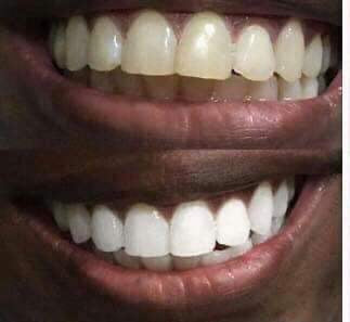 Whiten it Up! AP24 Toothpaste