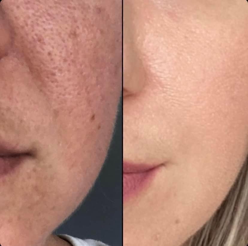 LumiSpa iO Essentials Kit