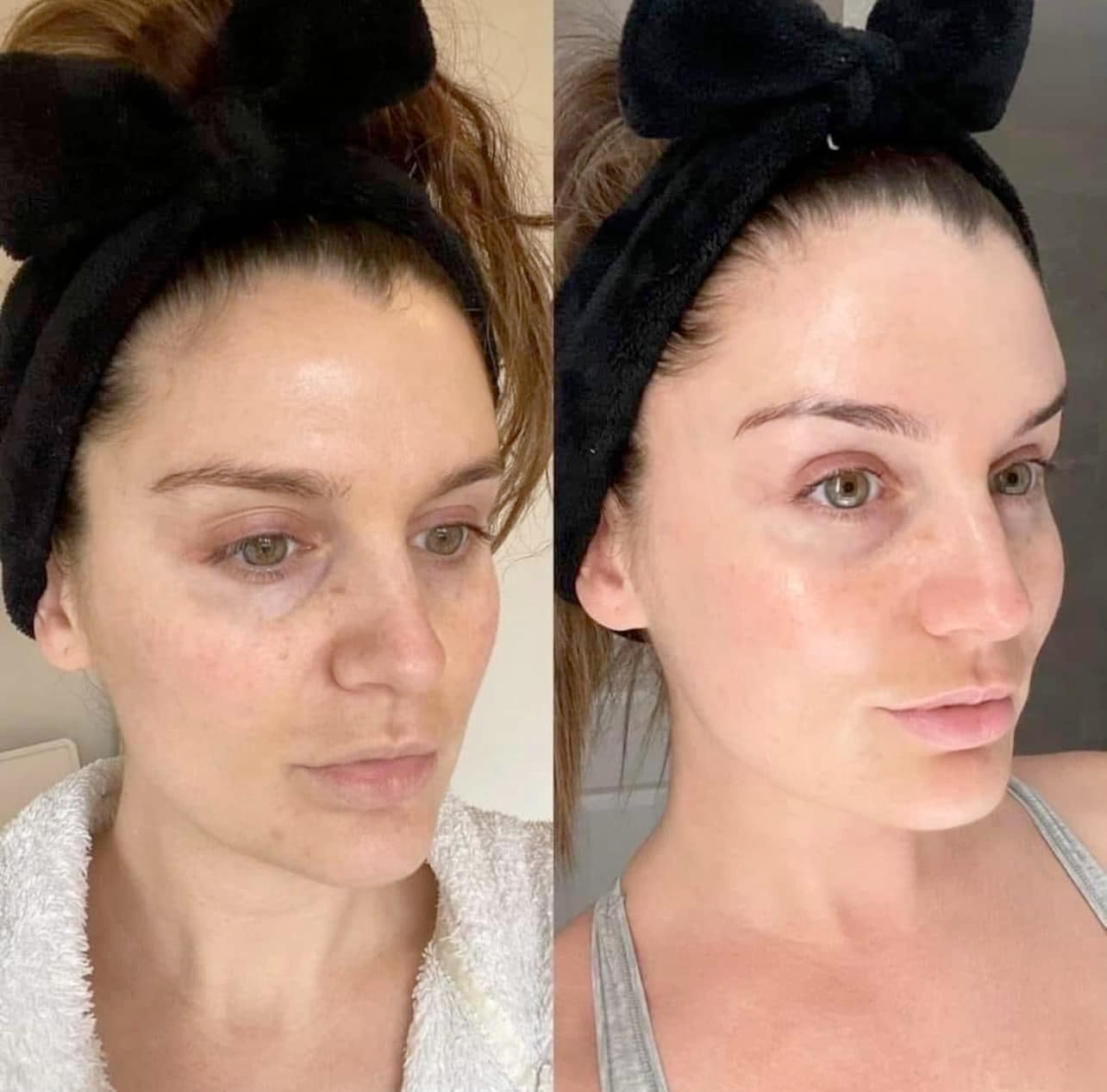 Boost Hydration Overnight - Pillow Glow