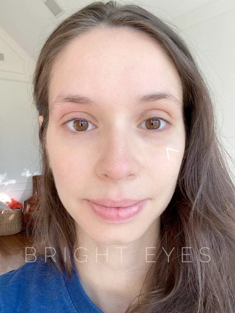 Eye Love Bright Eyes