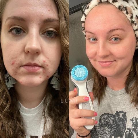 Summer LumiSpa + Nutricentials Bundle