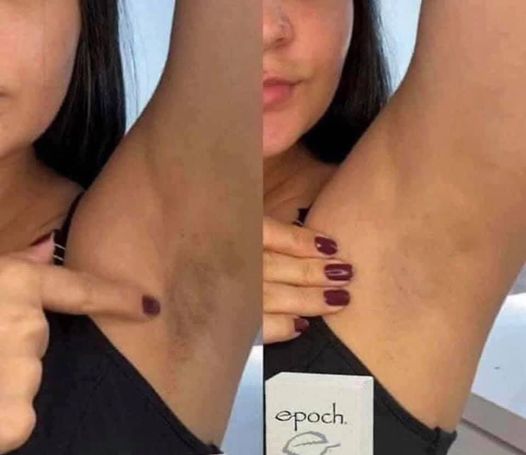 Gentle Exfoliation, KP relief - Epoch Polishing Bar