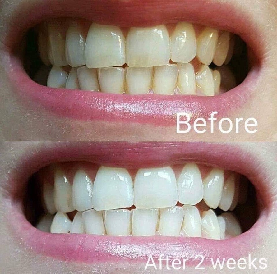Whiten it Up! AP24 Toothpaste