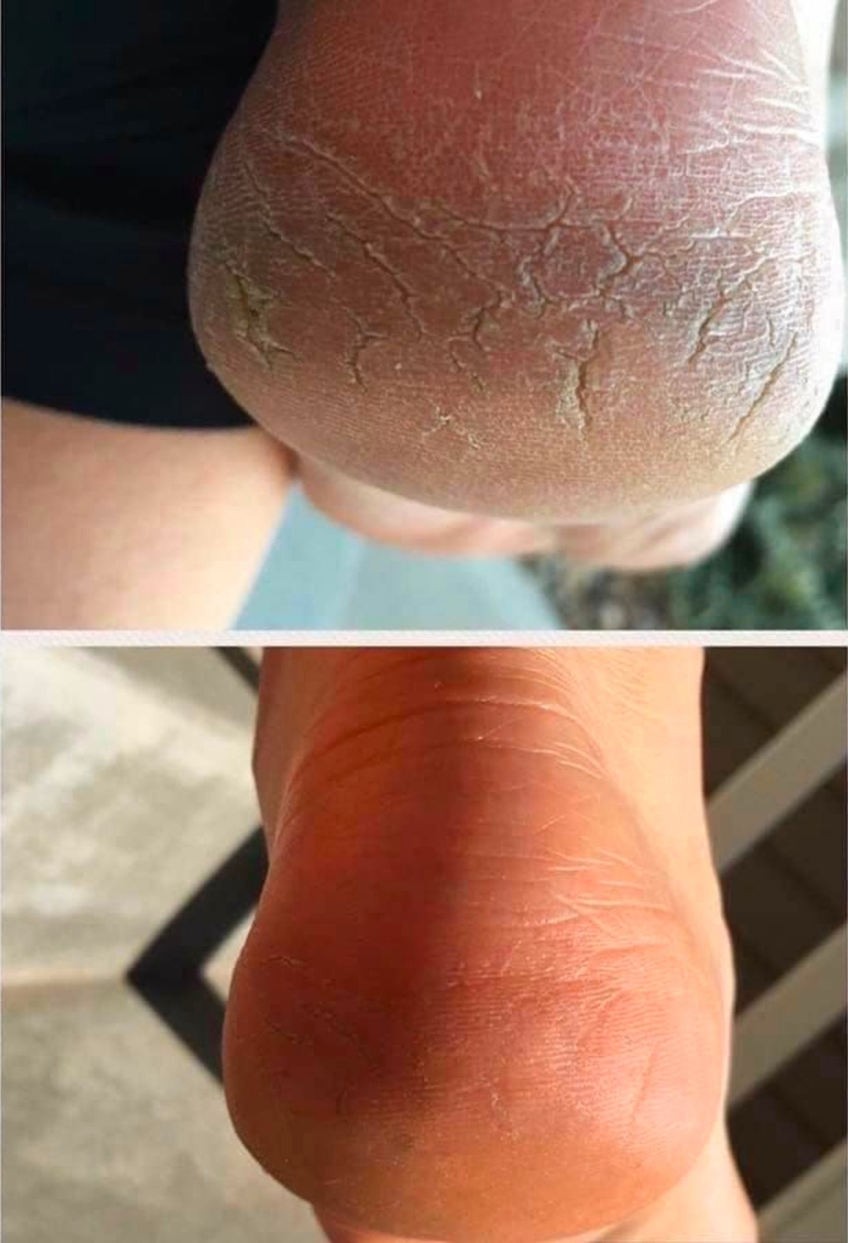 Treat Your Feet -- Sole Solution