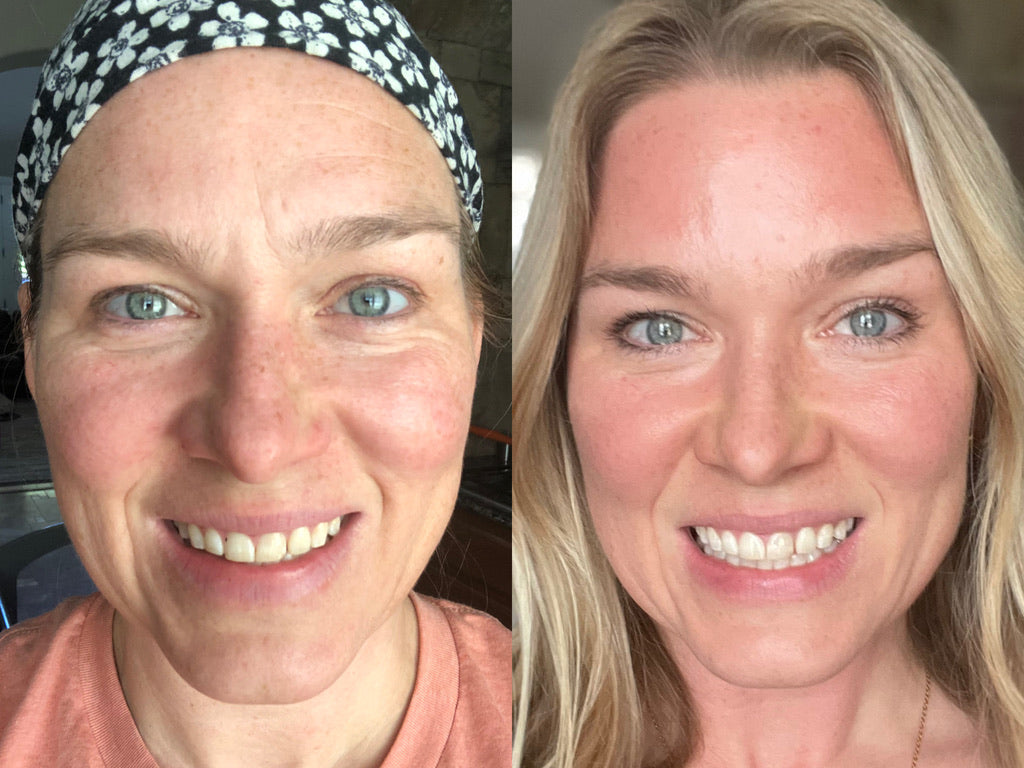 Summer LumiSpa + Nutricentials Bundle