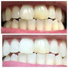 Whiten it Up! AP24 Toothpaste