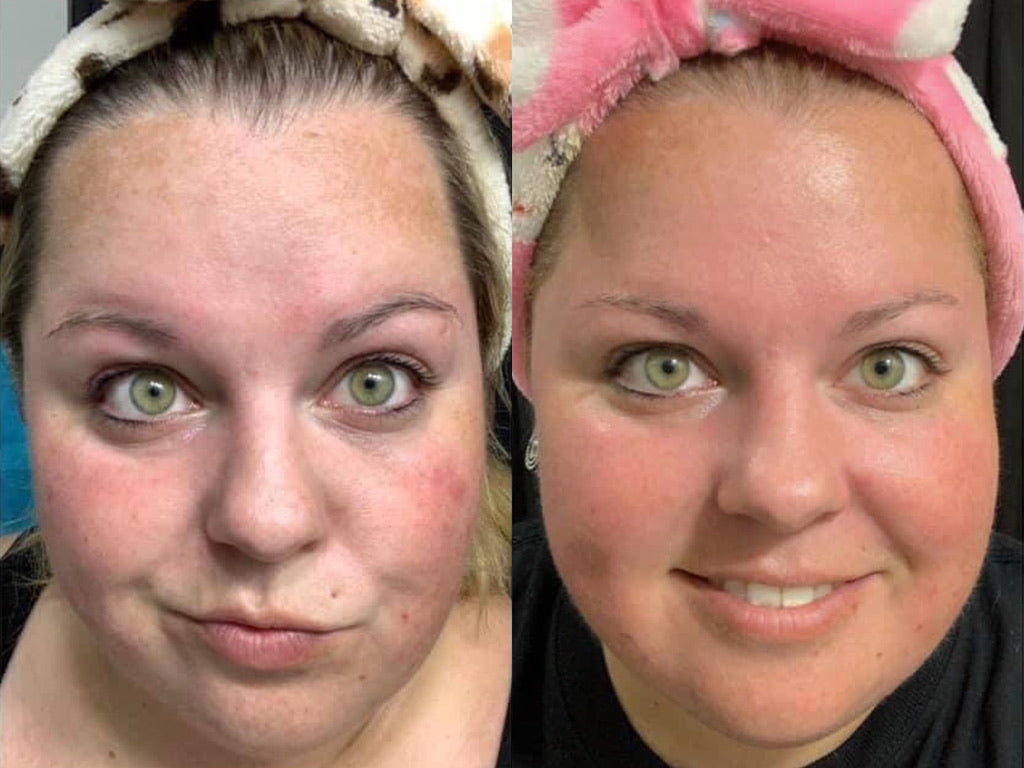 Summer LumiSpa + Nutricentials Bundle