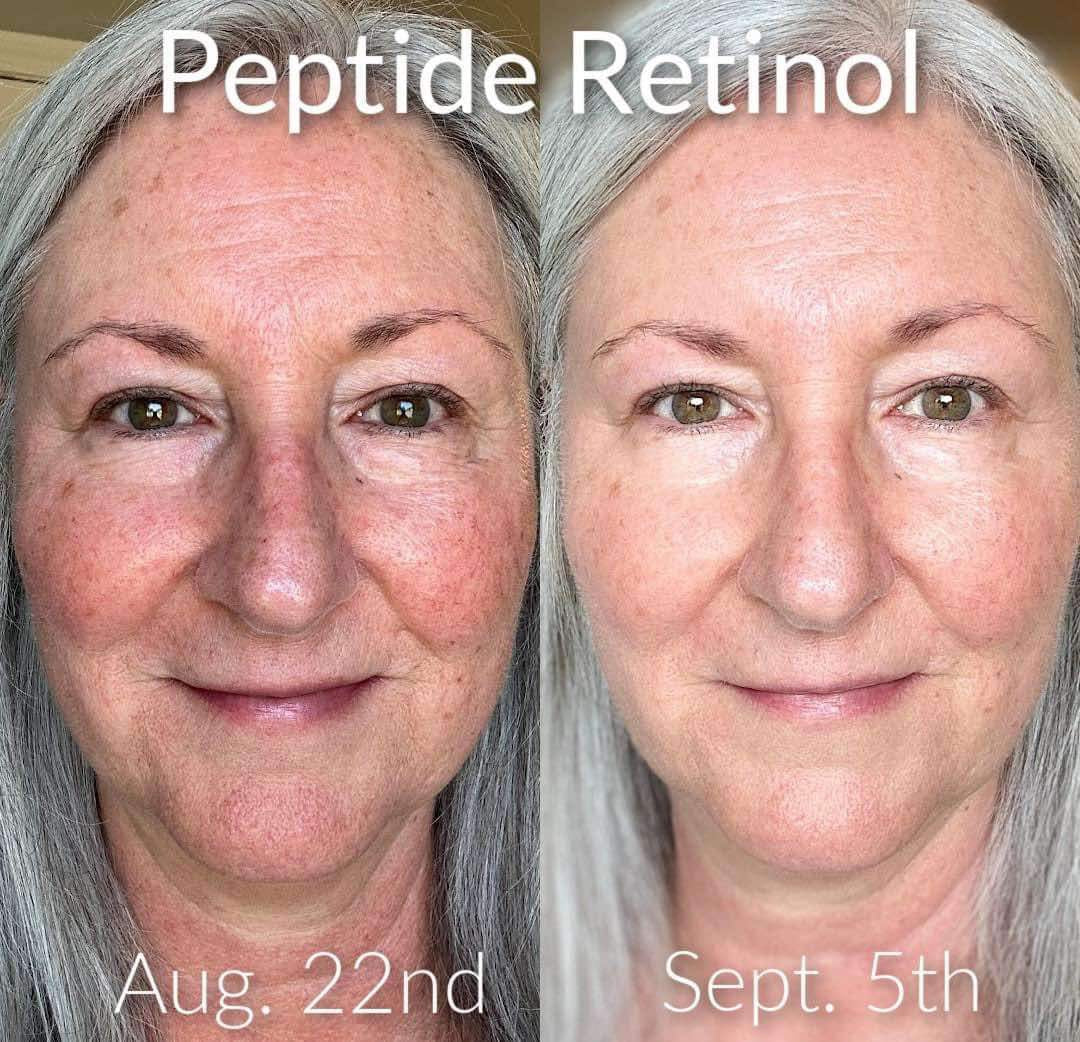 ageLoc Tru Face Peptide Retinol Complex - NOW AVAILABLE