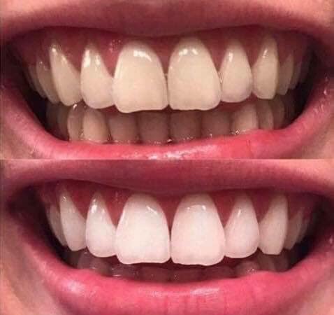Whiten it Up! AP24 Toothpaste