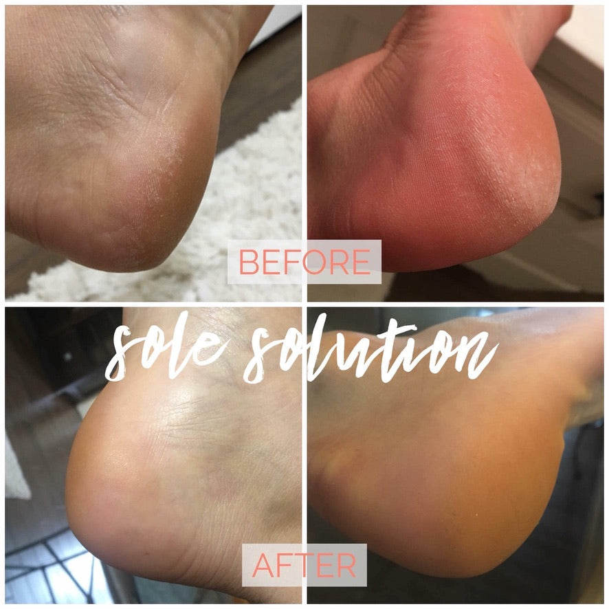 Treat Your Feet -- Sole Solution