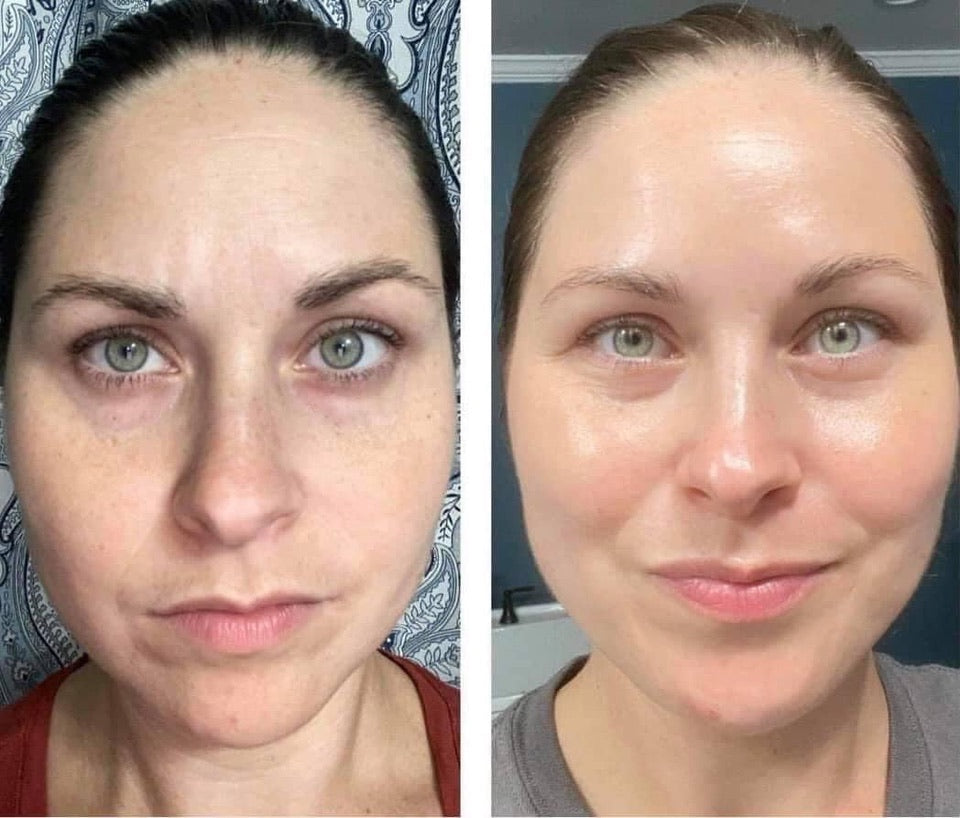 LumiSpa iO Essentials Kit