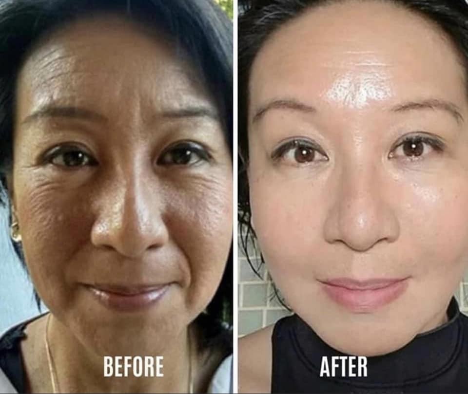 Summer LumiSpa + Nutricentials Bundle