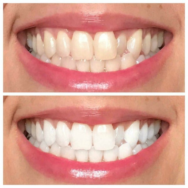 Whiten it Up! AP24 Toothpaste