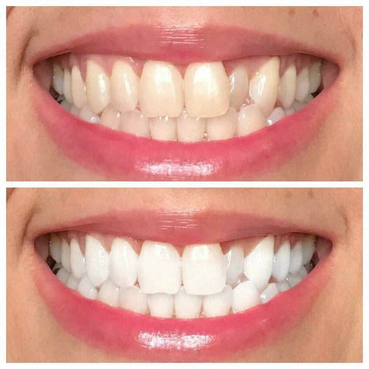 Whiten it Up! AP24 Toothpaste