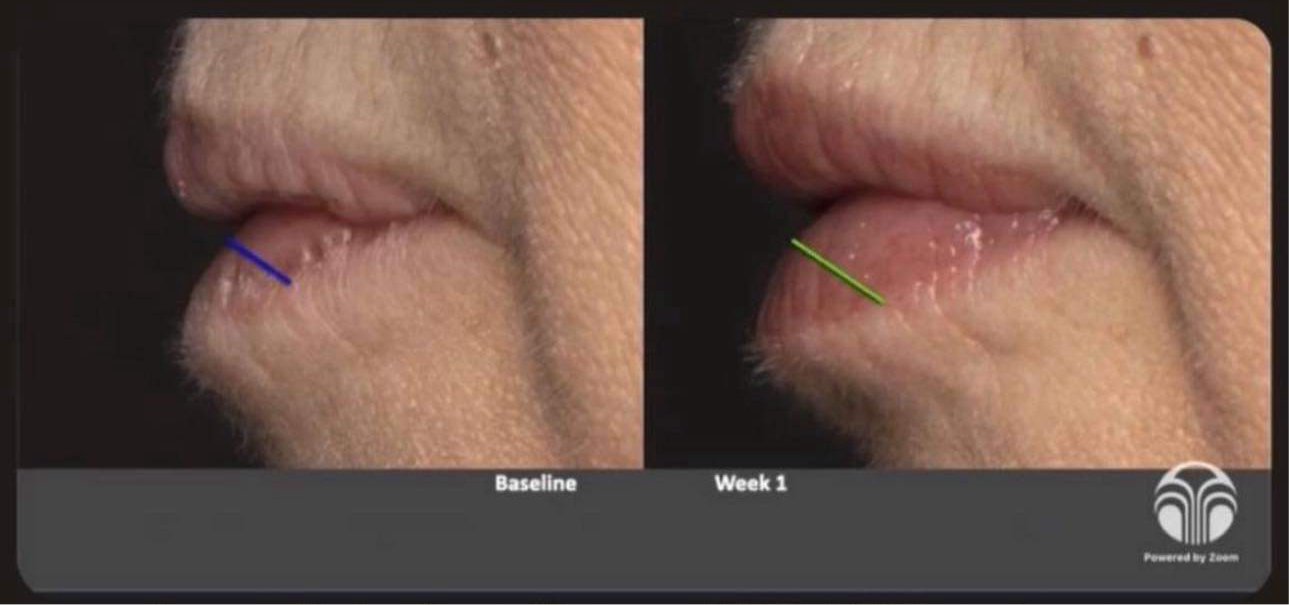 Nu Colour Peptide Pout