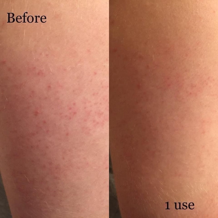 Gentle Exfoliation, KP relief - Epoch Polishing Bar