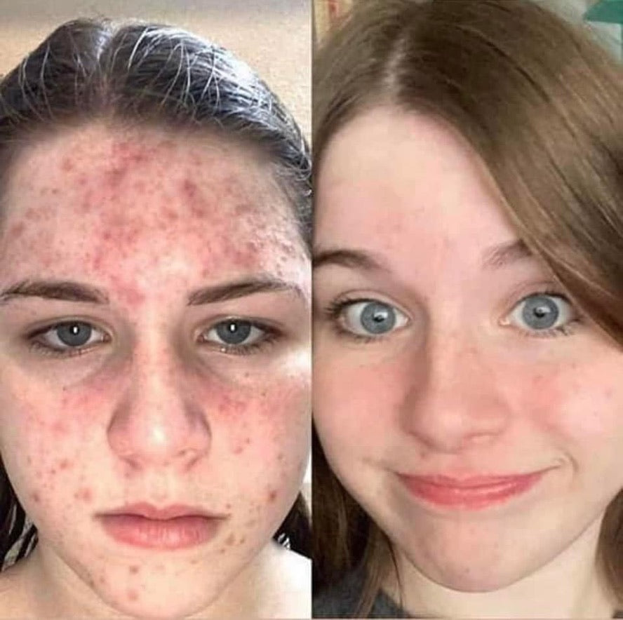 Summer LumiSpa + Nutricentials Bundle