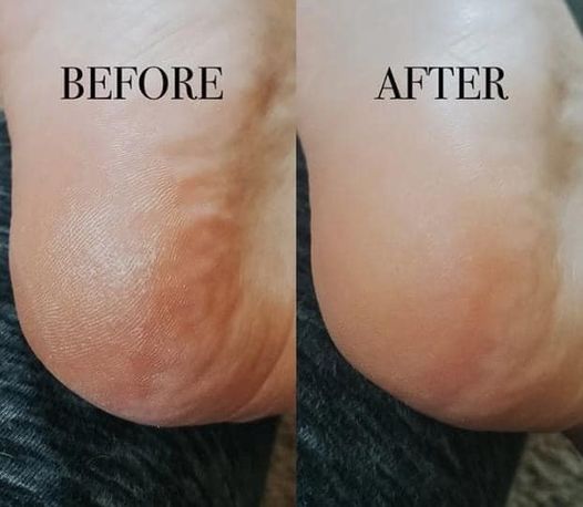 Treat Your Feet -- Sole Solution