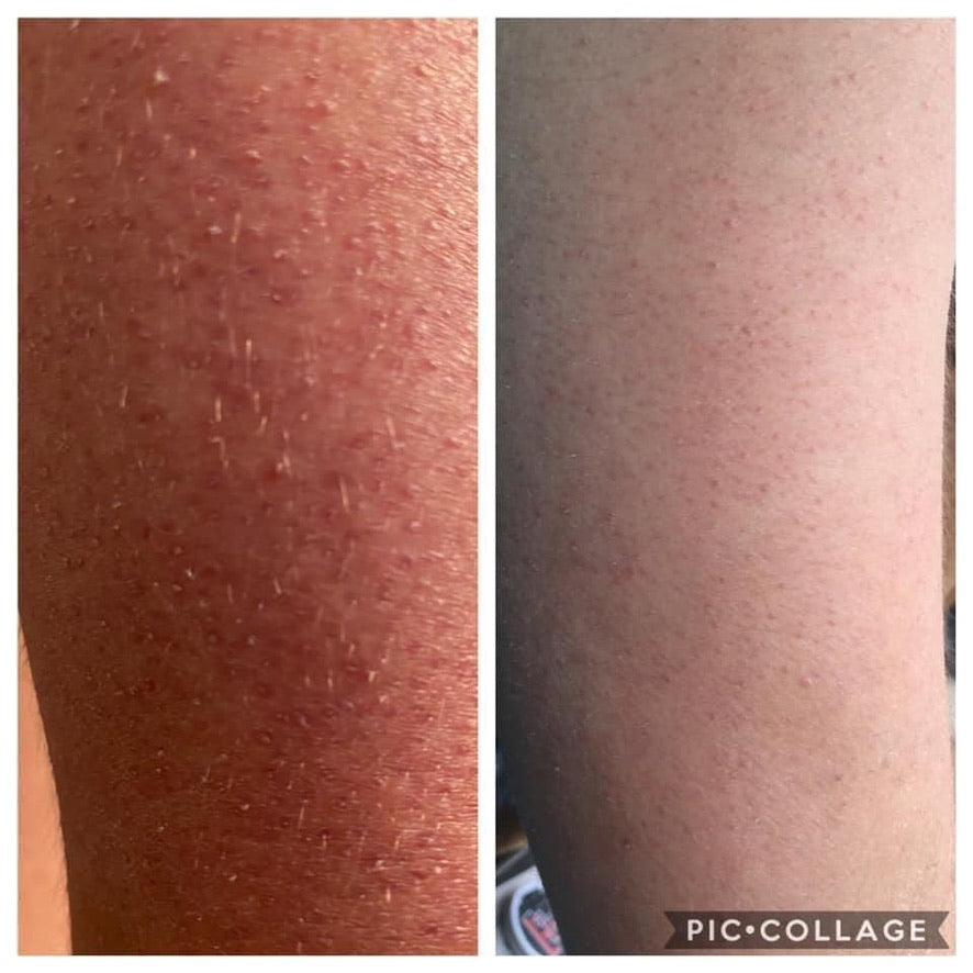 Gentle Exfoliation, KP relief - Epoch Polishing Bar