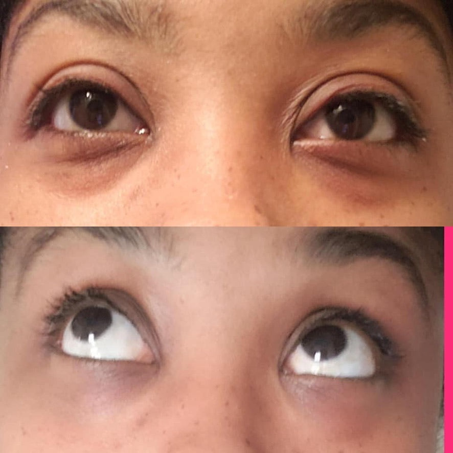 All About Eyes -- Ideal Eyes!