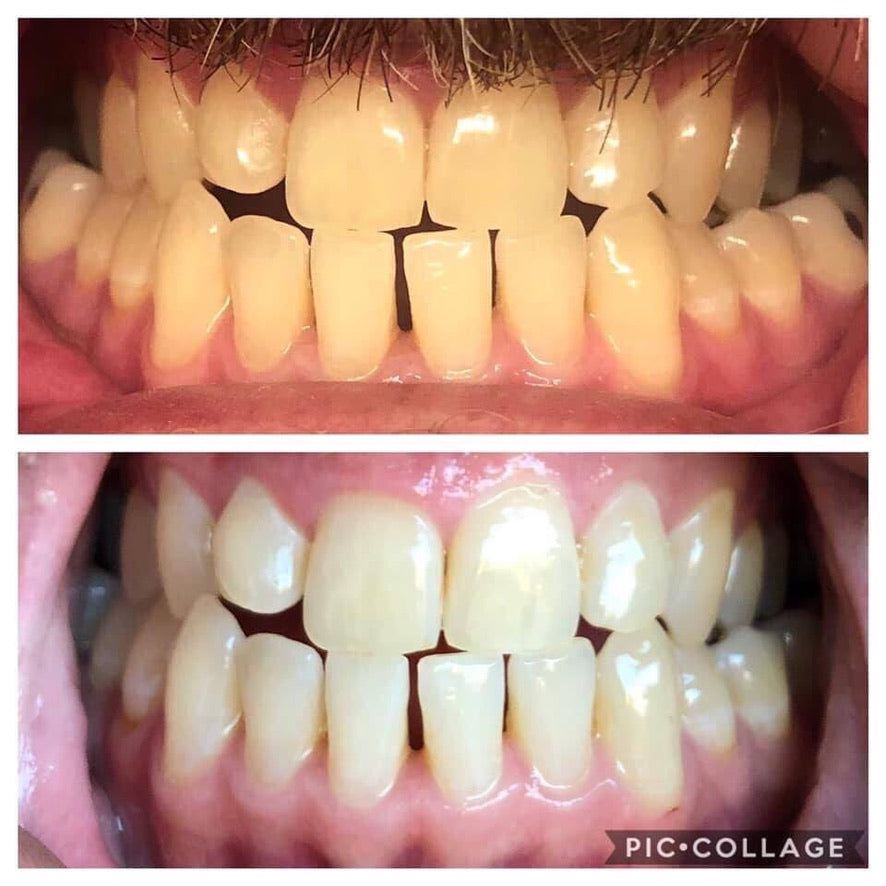 Whiten it Up! AP24 Toothpaste