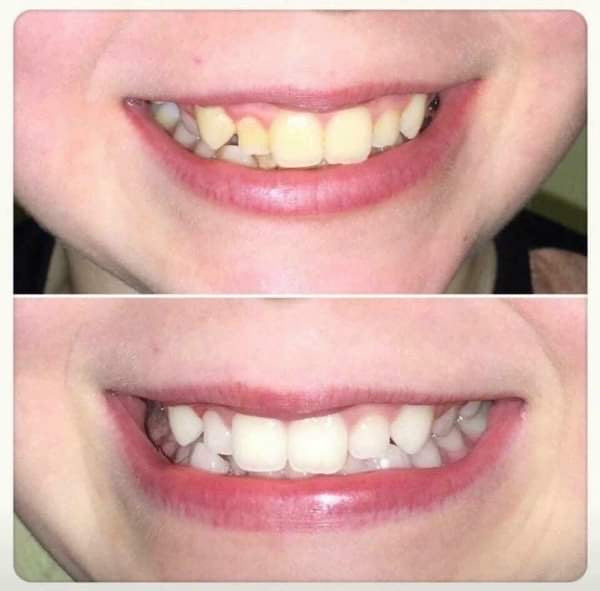 Whiten it Up! AP24 Toothpaste
