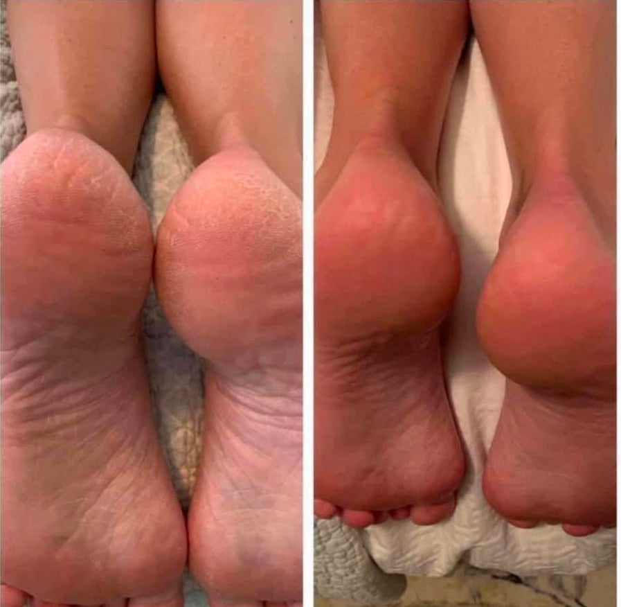 Treat Your Feet -- Sole Solution