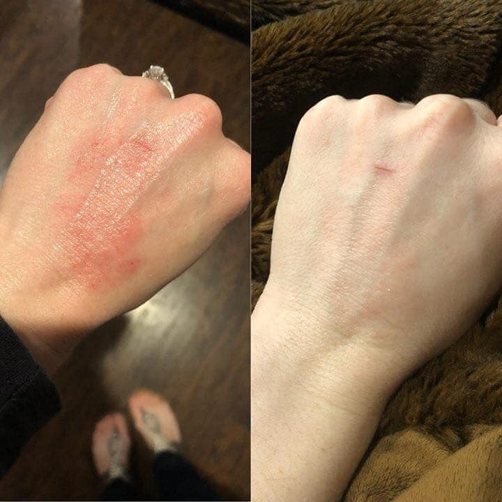 Sunburn Blaster - Epoch Body Butter!