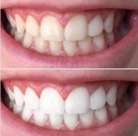 Whiten it Up! AP24 Toothpaste