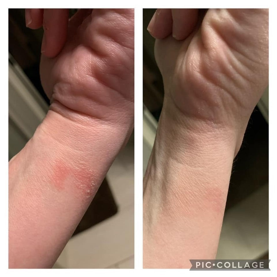 Sunburn Blaster - Epoch Body Butter!