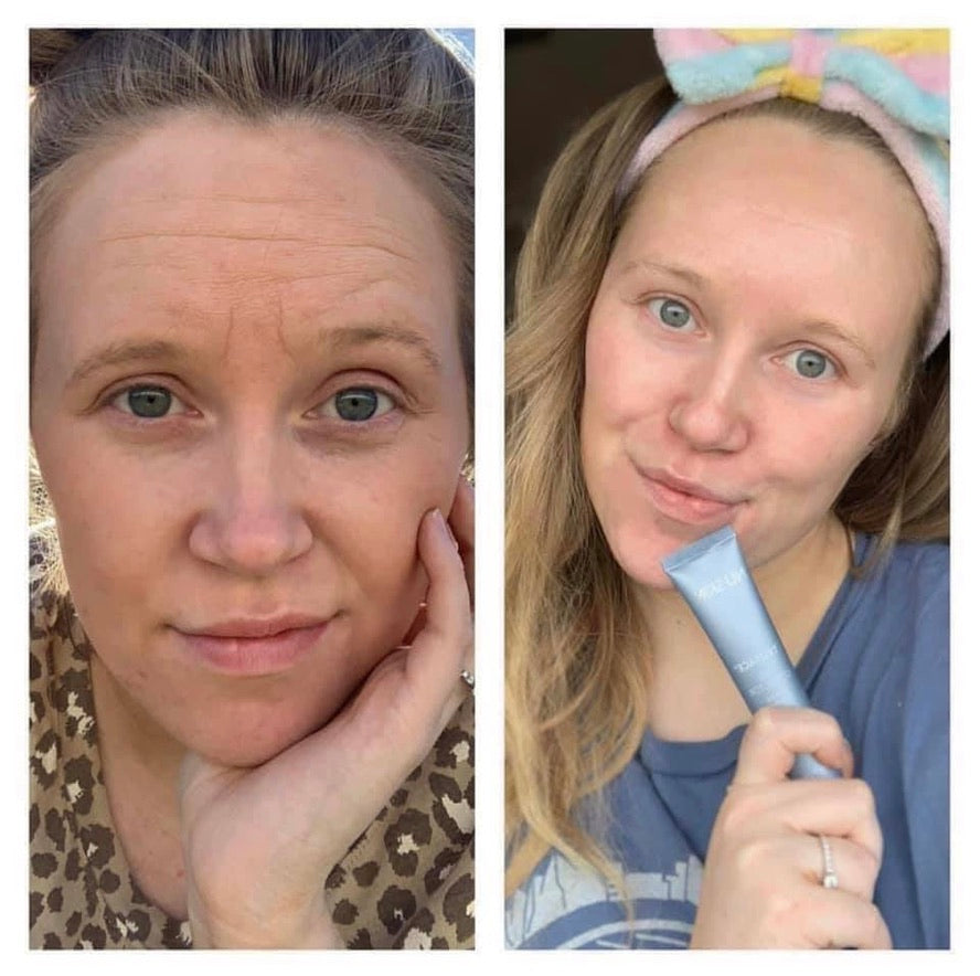 Tru Face Line Corrector