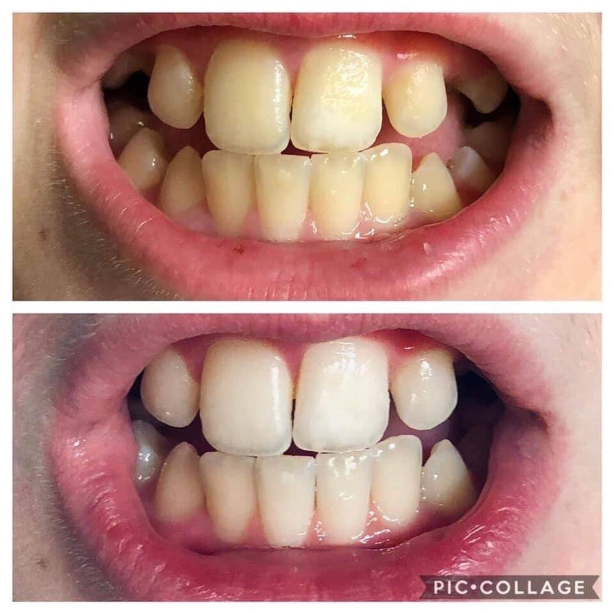 Whiten it Up! AP24 Toothpaste