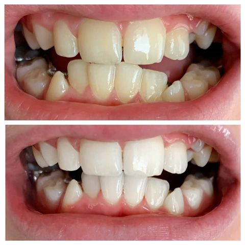 Whiten it Up! AP24 Toothpaste