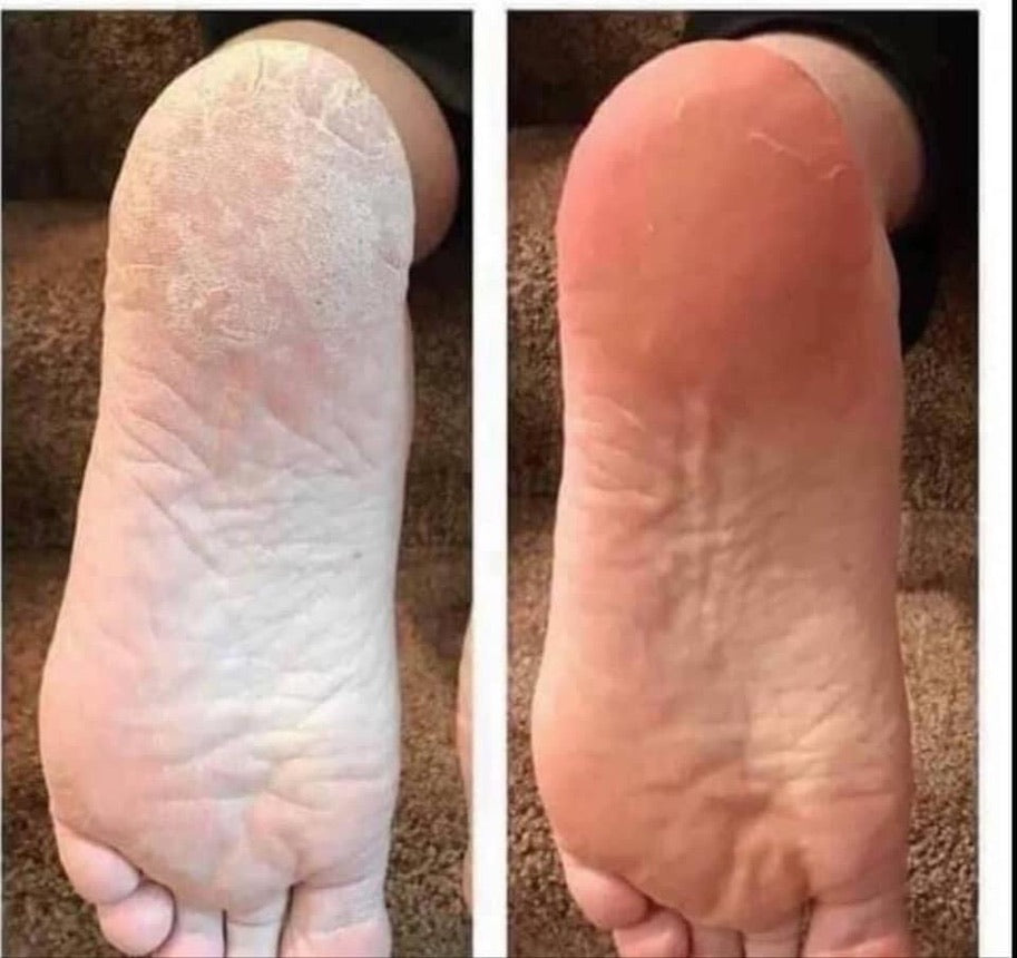 Treat Your Feet -- Sole Solution