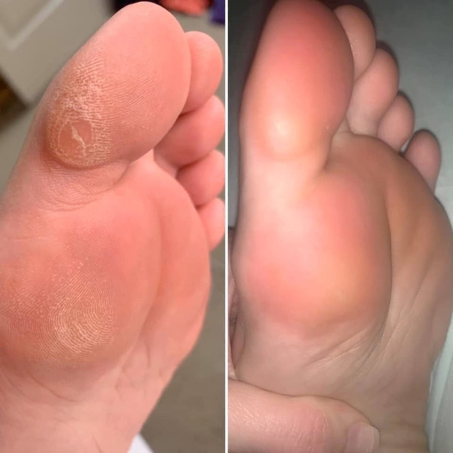Treat Your Feet -- Sole Solution