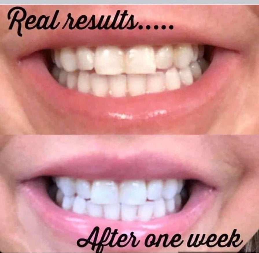 Whiten it Up! AP24 Toothpaste