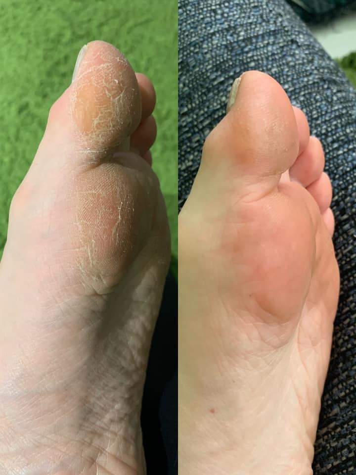 Treat Your Feet -- Sole Solution